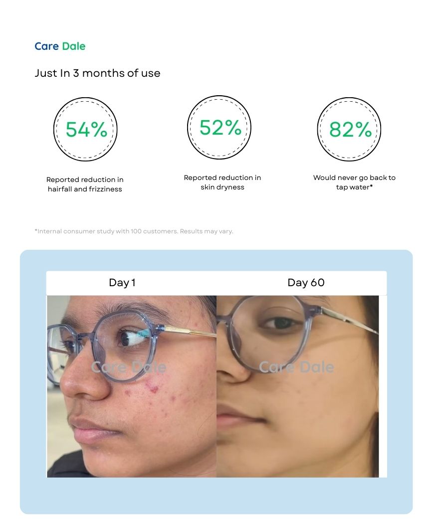 Replacement Cartridge for Borewell/Tanker Water - Care Dale