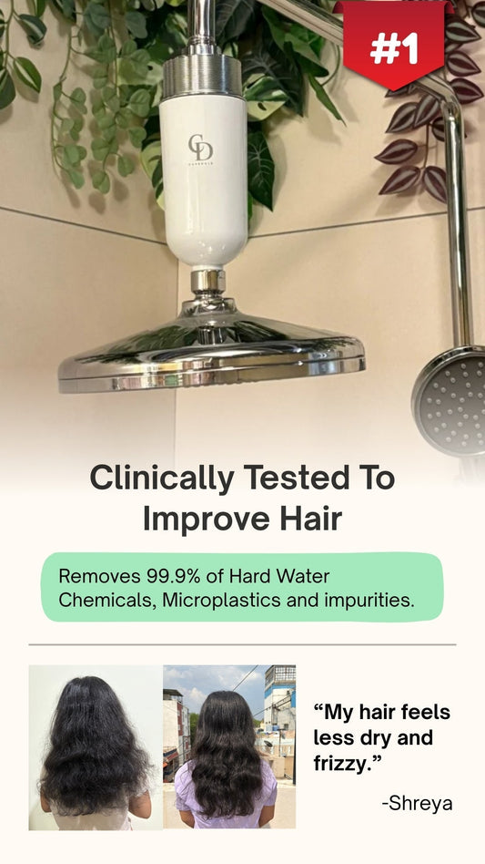 Hair Loss due to Hard Water in Bangalore- Care Dale's Complete Guide