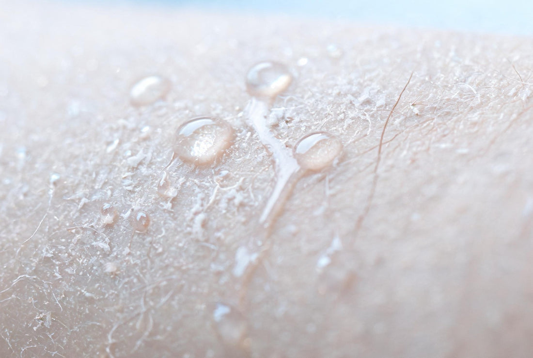 What the evidence shows about soft water, filters and eczema-prone skin in India