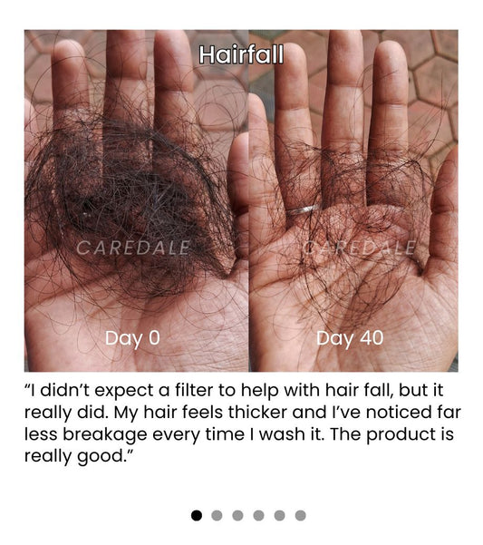 Before/After: How I Saved My Hair from Hard Water Damage in 30 Days