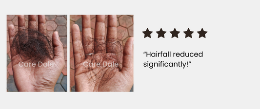 The Connection Between Water Hardness and Hair Fall: How to Stop It?