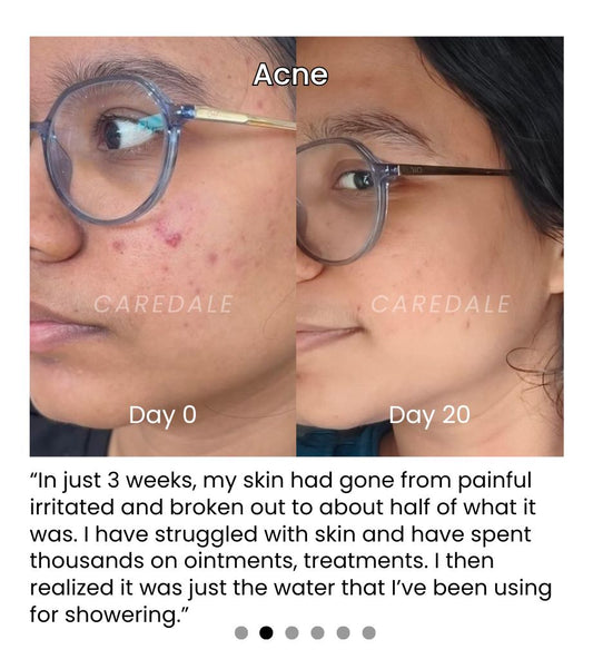 Viral Beauty Hack: How Filtered Shower Water Became a Instagram Staple for Healthier Hair