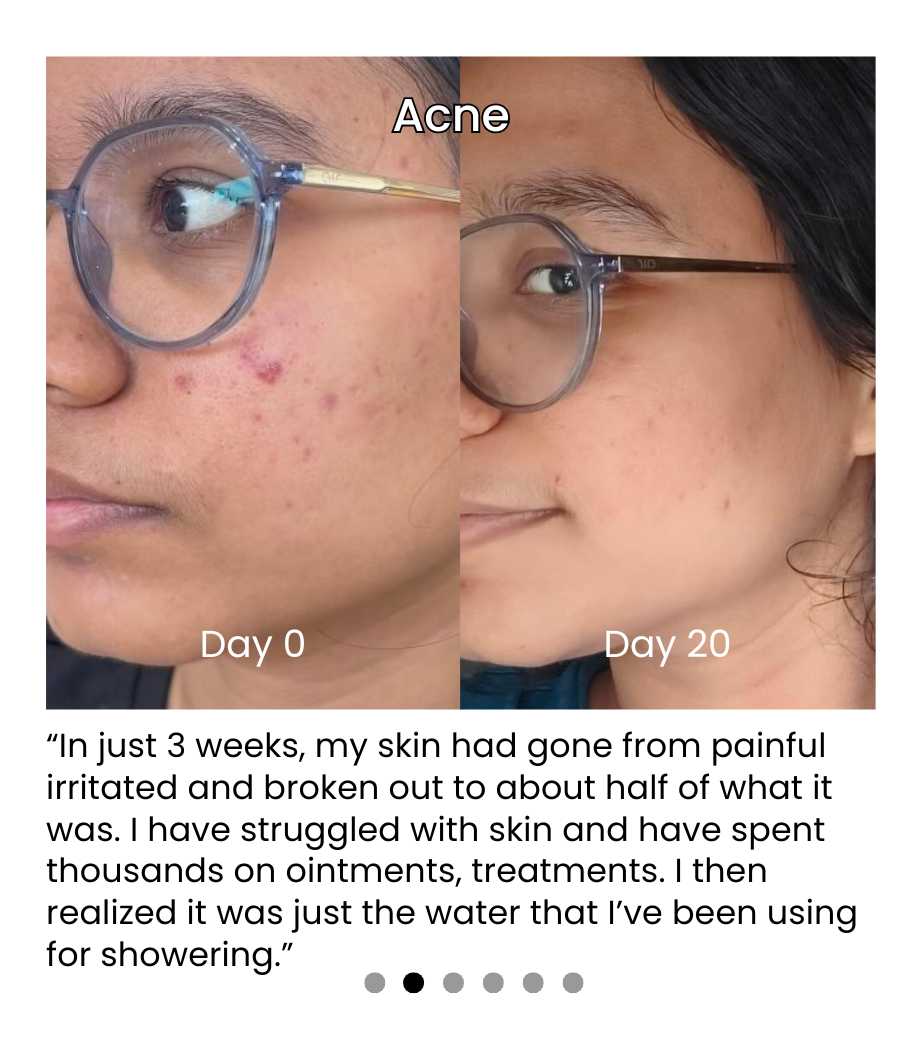 Hard Water and Its Impact on Your Beauty Routine