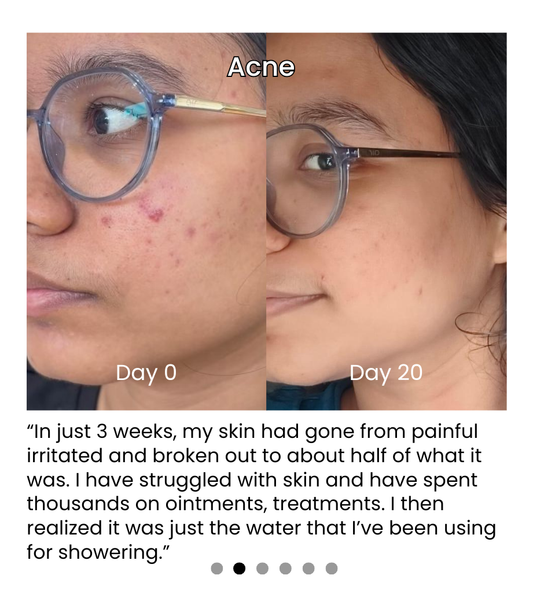 Hard Water and Its Impact on Your Beauty Routine