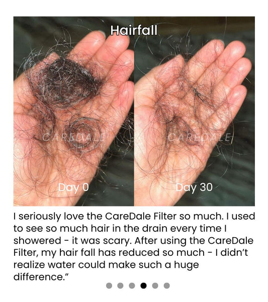 How Hard Water Causes Hair Fall: Solutions with Shower Filters