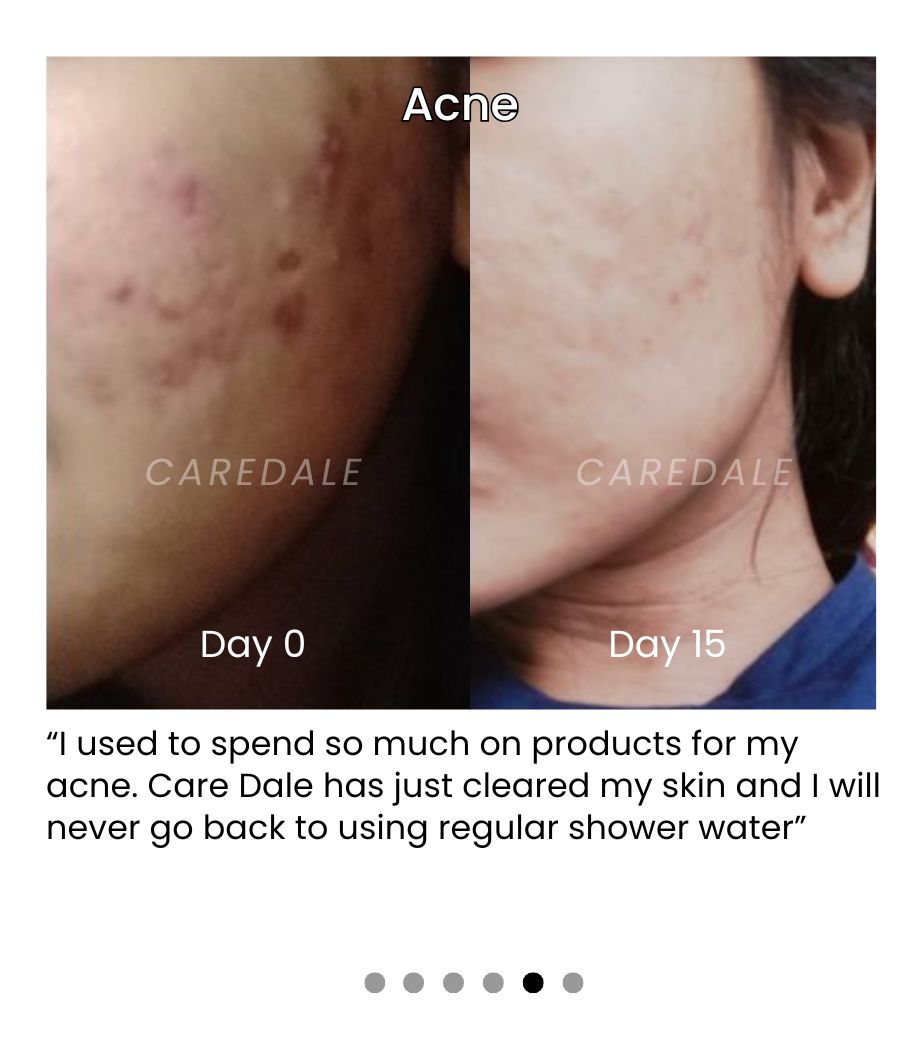 How Water Quality Impacts Skin Aging and What You Can Do About It