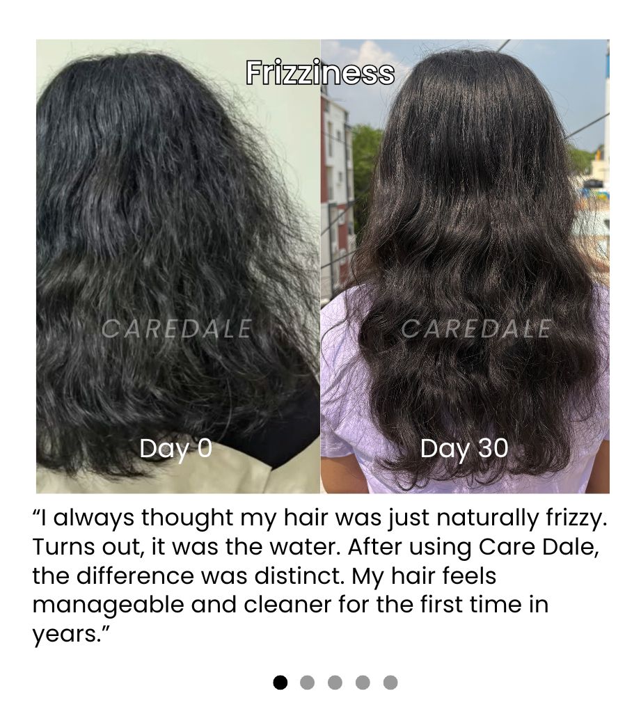 How Hard Water Affects Hair: Dermatologists Explain Long-Term Damage