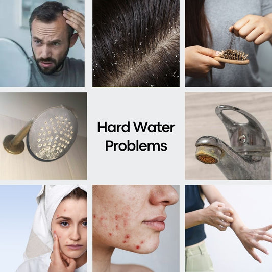 5 Warning Signs That You’re Using Hard Water: What You Need to Do