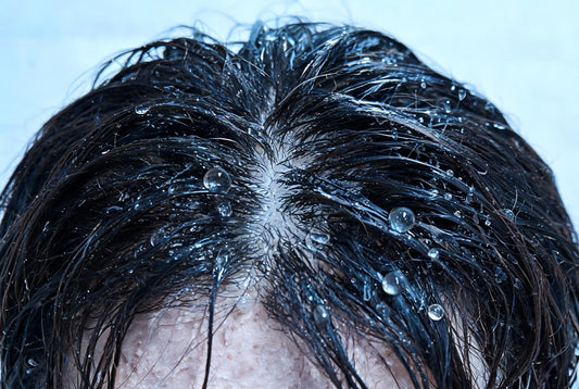 Why hard water and chlorine leave the scalp itchy after every shower, and how a filter helps in India