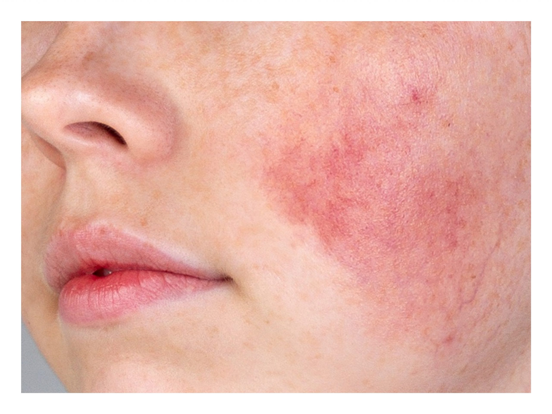 The Impact of Hard Water on Sensitive Skin: An In-Depth Analysis