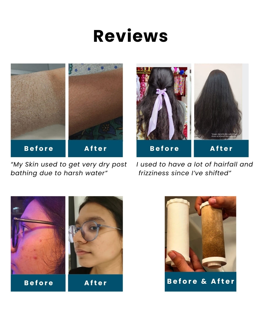 Care Dale Filter for Borewell/ Tanker Water