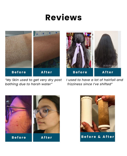 Care Dale Filter for Borewell/ Tanker Water