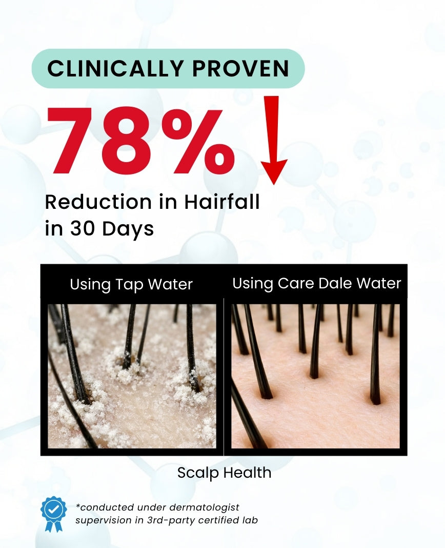 Care Dale Filter For Municipal Water