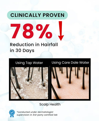 Care Dale Filter For Municipal Water